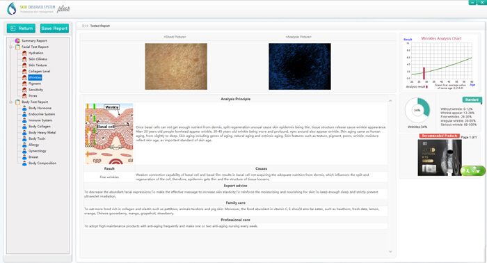skin test report - Derma shine pro, Microneedling pen and serum, skin ...