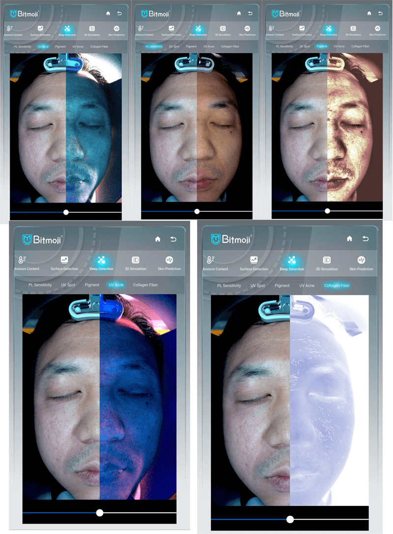 skin scanning machine