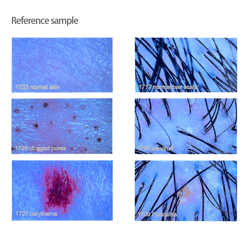 skin and hair analysis