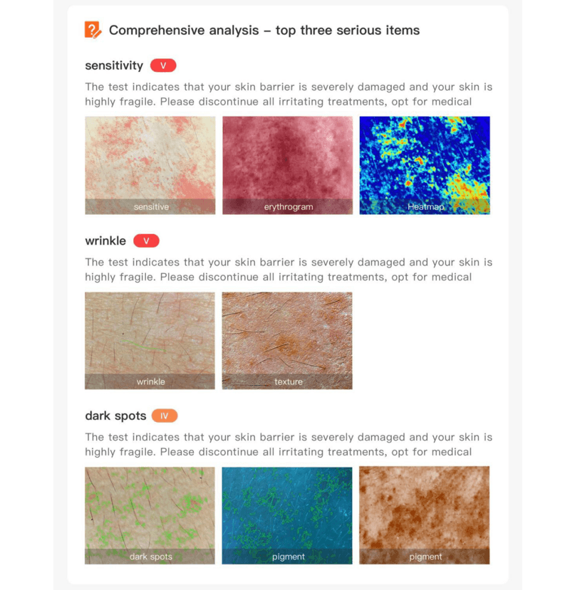 skin analyzer 